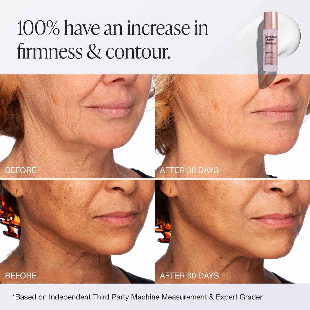 Buy Now Price- InnBeauty Project Extreme Cream - Picture 2 of 7